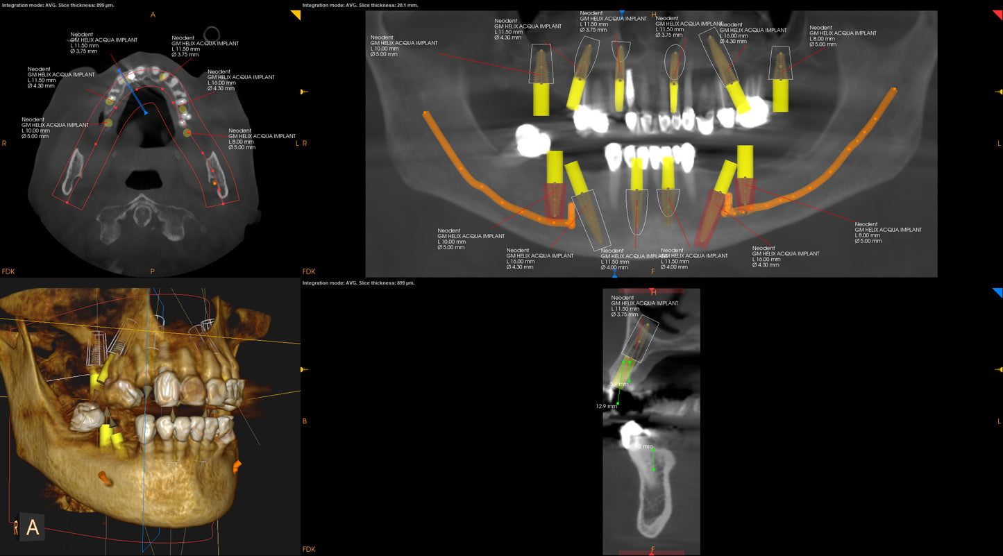 Corps Bootcamp Fundamentals - Engaging High Impact Training for Fixed, Full-Arch + Basic Cadaver Lab